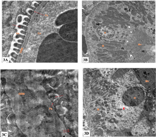 biomedres-openaccess-journal-bjstr