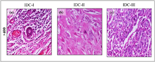 biomedres-openaccess-journal-bjstr