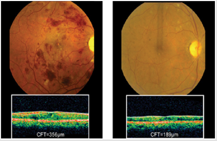 biomedres-openaccess-journal-bjstr