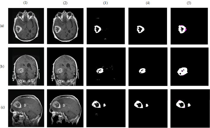 biomedres-openaccess-journal-bjstr
