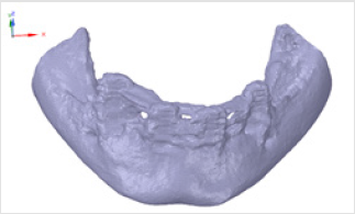 biomedres-openaccess-journal-bjstr