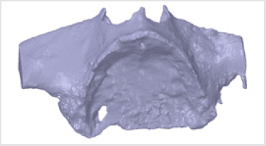 biomedres-openaccess-journal-bjstr