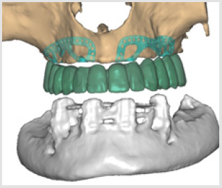 biomedres-openaccess-journal-bjstr