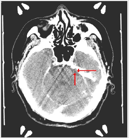 biomedres-openaccess-journal-bjstr