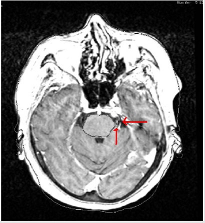 biomedres-openaccess-journal-bjstr