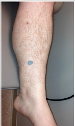 biomedres-openaccess-journal-bjstr