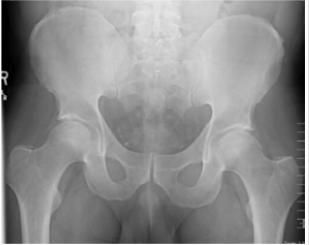 biomedres-openaccess-journal-bjstr