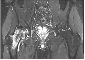 biomedres-openaccess-journal-bjstr