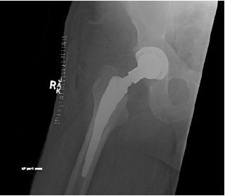 biomedres-openaccess-journal-bjstr