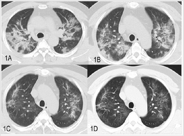 biomedres-openaccess-journal-bjstr
