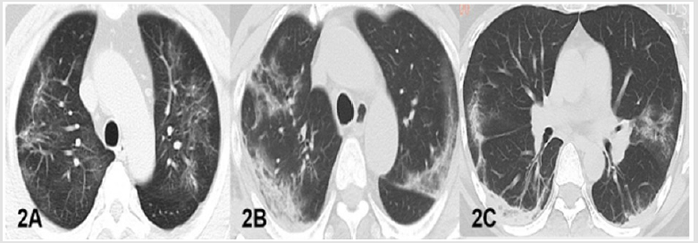 biomedres-openaccess-journal-bjstr