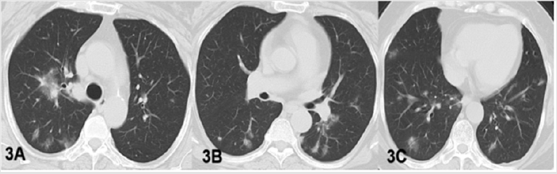 biomedres-openaccess-journal-bjstr