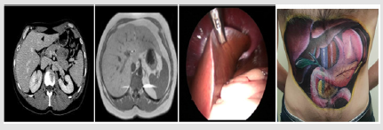 biomedres-openaccess-journal-bjstr