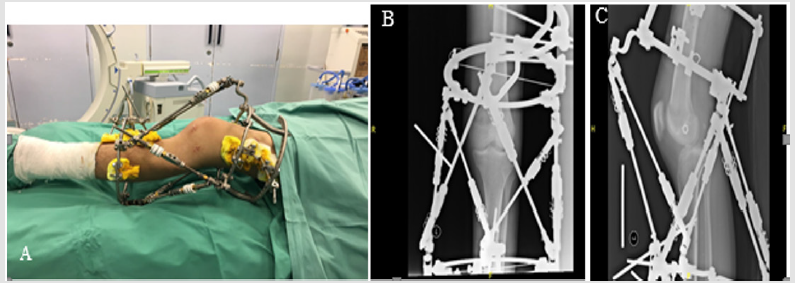 biomedres-openaccess-journal-bjstr