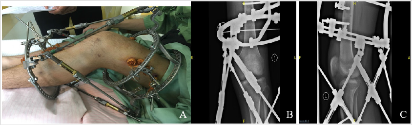 biomedres-openaccess-journal-bjstr
