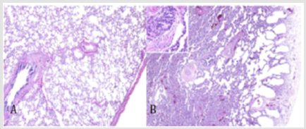 biomedres-openaccess-journal-bjstr