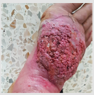 biomedres-openaccess-journal-bjstr