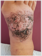 biomedres-openaccess-journal-bjstr