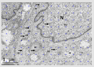 biomedres-openaccess-journal-bjstr
