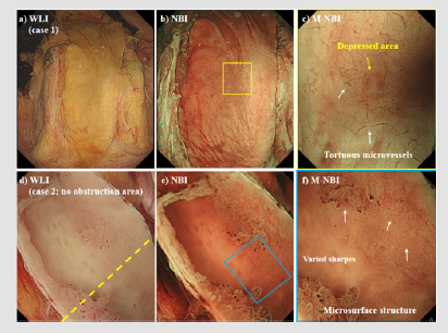 biomedres-openaccess-journal-bjstr