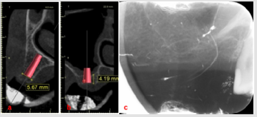 biomedres-openaccess-journal-bjstr