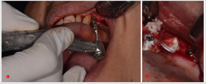 biomedres-openaccess-journal-bjstr