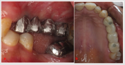 biomedres-openaccess-journal-bjstr