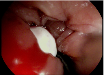 biomedres-openaccess-journal-bjstr
