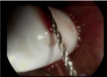 biomedres-openaccess-journal-bjstr