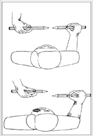 biomedres-openaccess-journal-bjstr