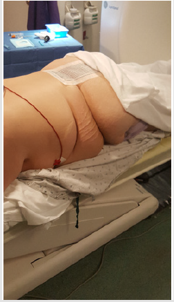 biomedres-openaccess-journal-bjstr