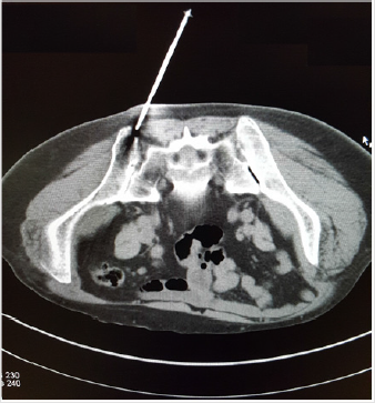 biomedres-openaccess-journal-bjstr