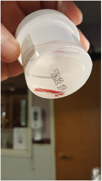 biomedres-openaccess-journal-bjstr