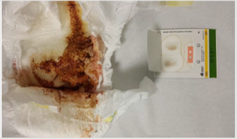 biomedres-openaccess-journal-bjstr