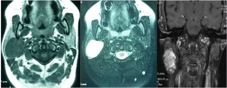 biomedres-openaccess-journal-bjstr