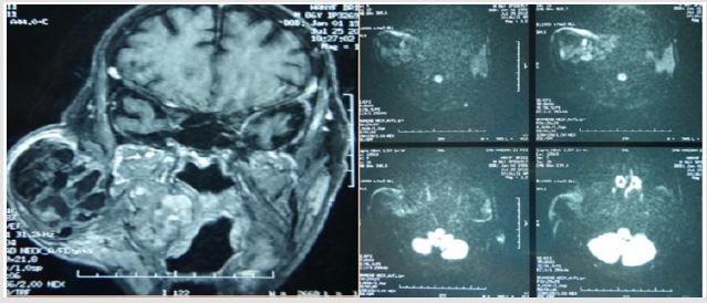 biomedres-openaccess-journal-bjstr