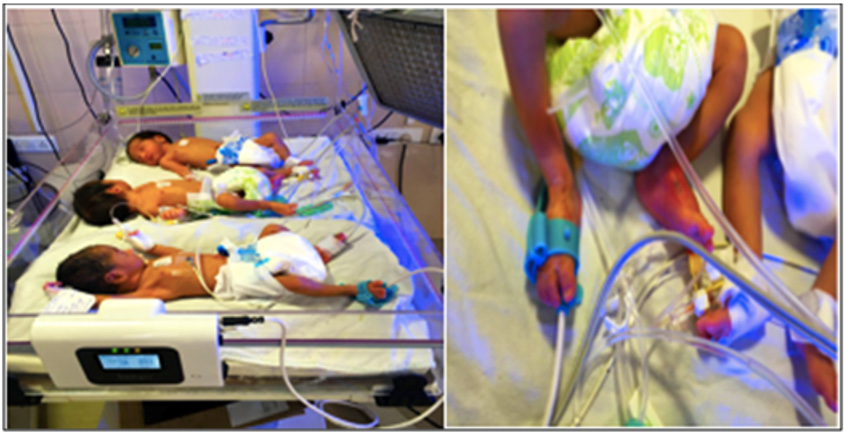 biomedres-openaccess-journal-bjstr