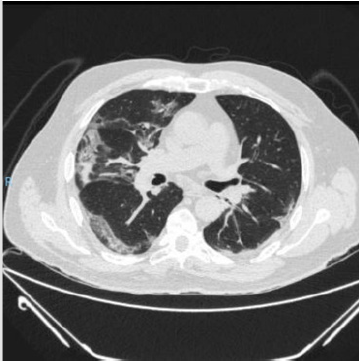 biomedres-openaccess-journal-bjstr