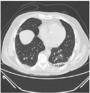 biomedres-openaccess-journal-bjstr