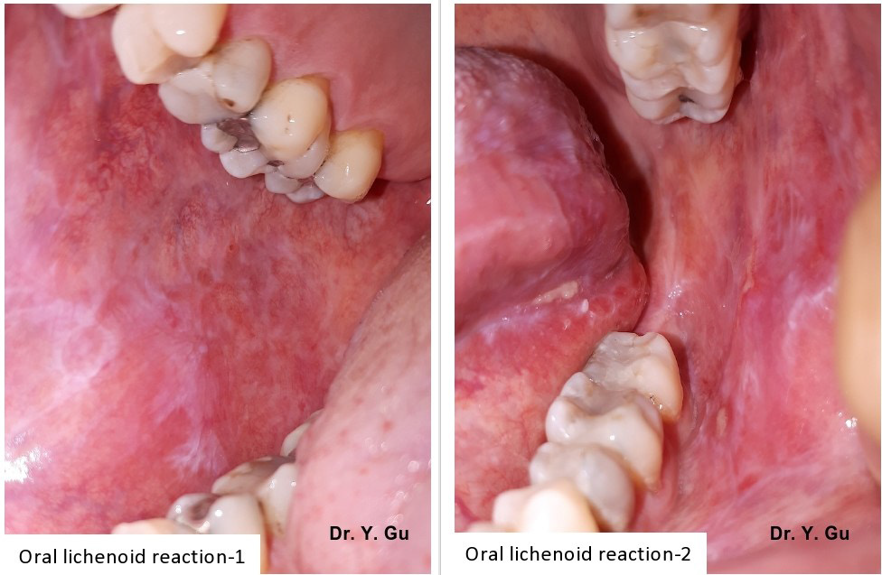 biomedres-openaccess-journal-bjstr