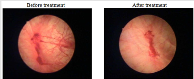 biomedres-openaccess-journal-bjstr