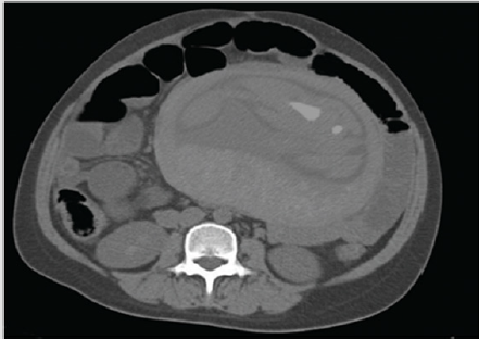 biomedres-openaccess-journal-bjstr