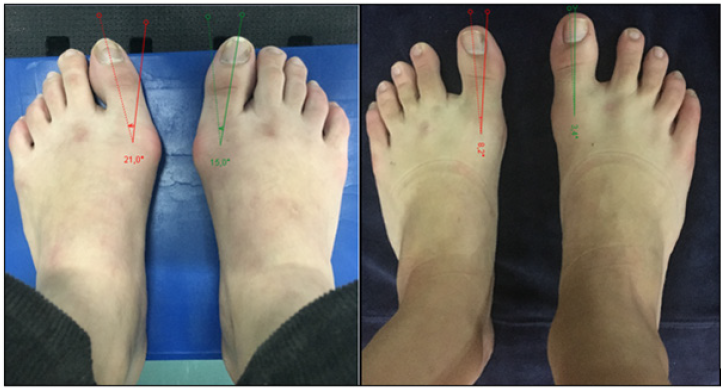 biomedres-openaccess-journal-bjstr