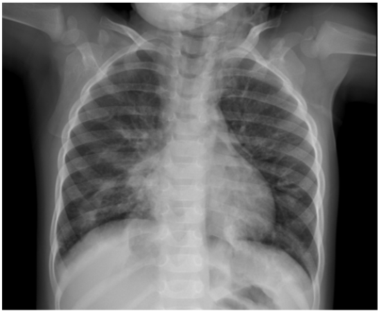 biomedres-openaccess-journal-bjstr