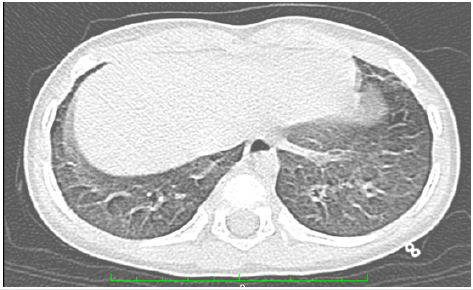 biomedres-openaccess-journal-bjstr