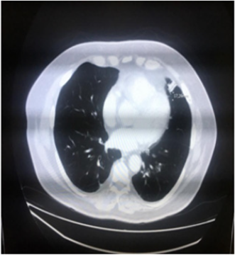 biomedres-openaccess-journal-bjstr