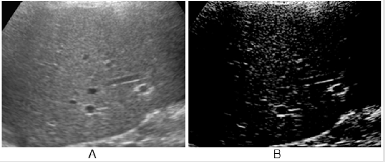 biomedres-openaccess-journal-bjstr