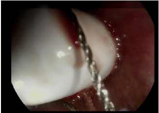 biomedres-openaccess-journal-bjstr