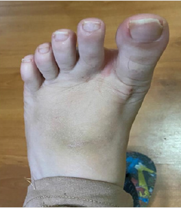 biomedres-openaccess-journal-bjstr