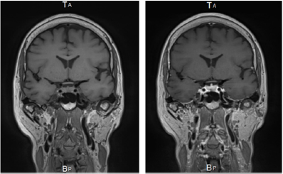 biomedres-openaccess-journal-bjstr